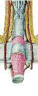 Tendovaginitis Stenosans "Schnappfinger"